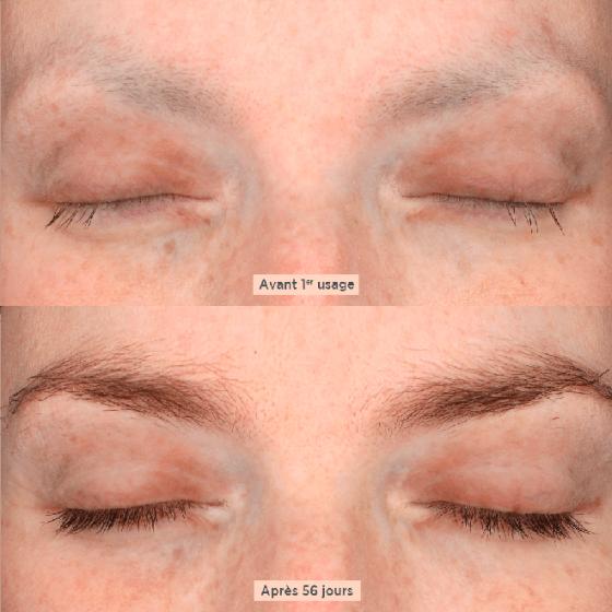 Réparation de cils endommagés à Genève